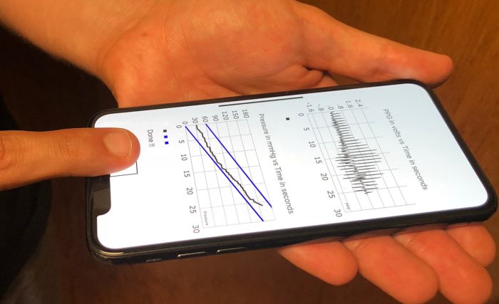 Artificial Intelligence App for Monitoring Blood Pressure An Overview